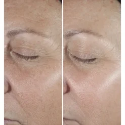 CLINIQUE Sérum Et Booster|Smart Clinical Repair                Sérum Correcteur Anti-Rides