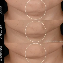 LANCÔME Soin Jour & Nuit|Rénergie H.P.N. 300-Peptide                Crème Anti-Âge Haute-Performance